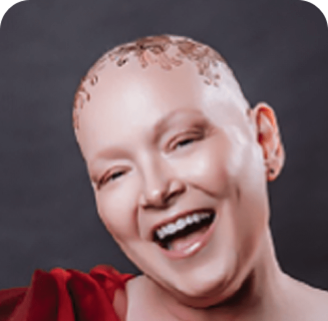 Tanya, a TRODELVY Ambassador